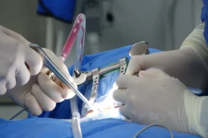 Gizmo Medical Transforms OEM Collaborations with Tailor-Made Surgical System Solutions